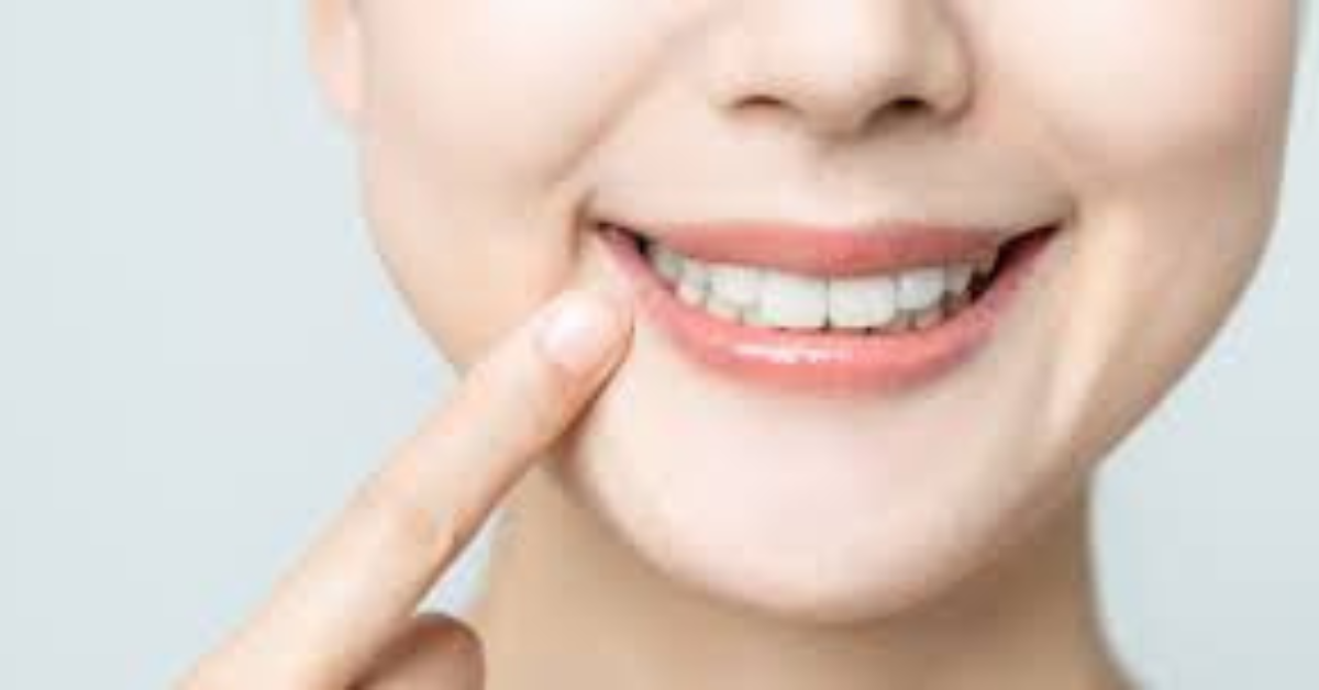 Personal Dental Care Plan
